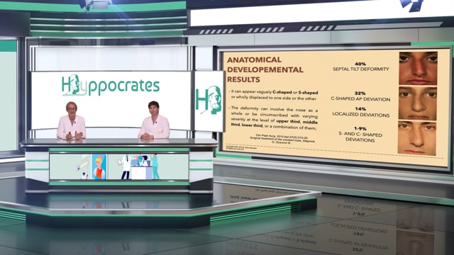 Post-traumatic crooked nose deformity treatment